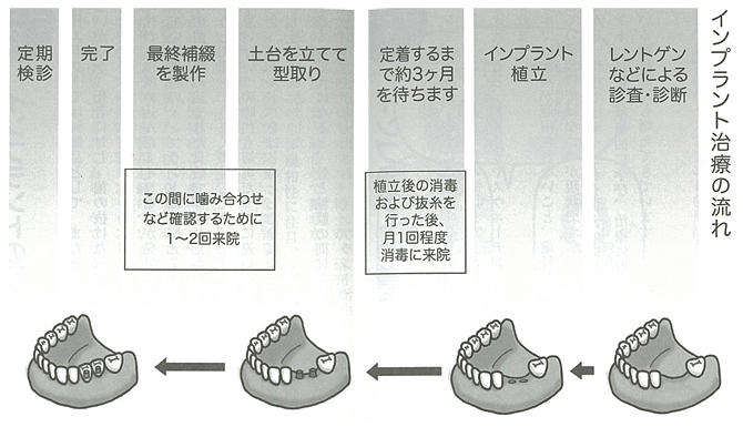 治療の手順